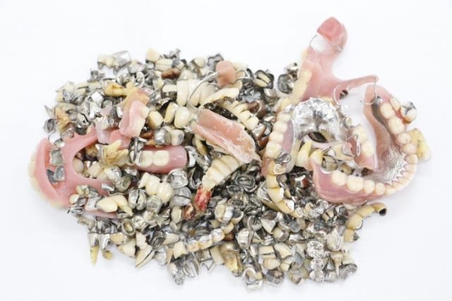 金パラ・歯科金属スクラップ